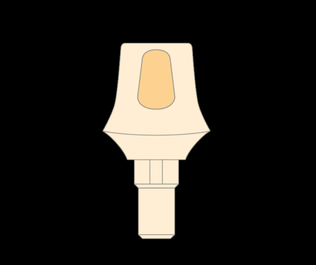 abutment_zweiteilig